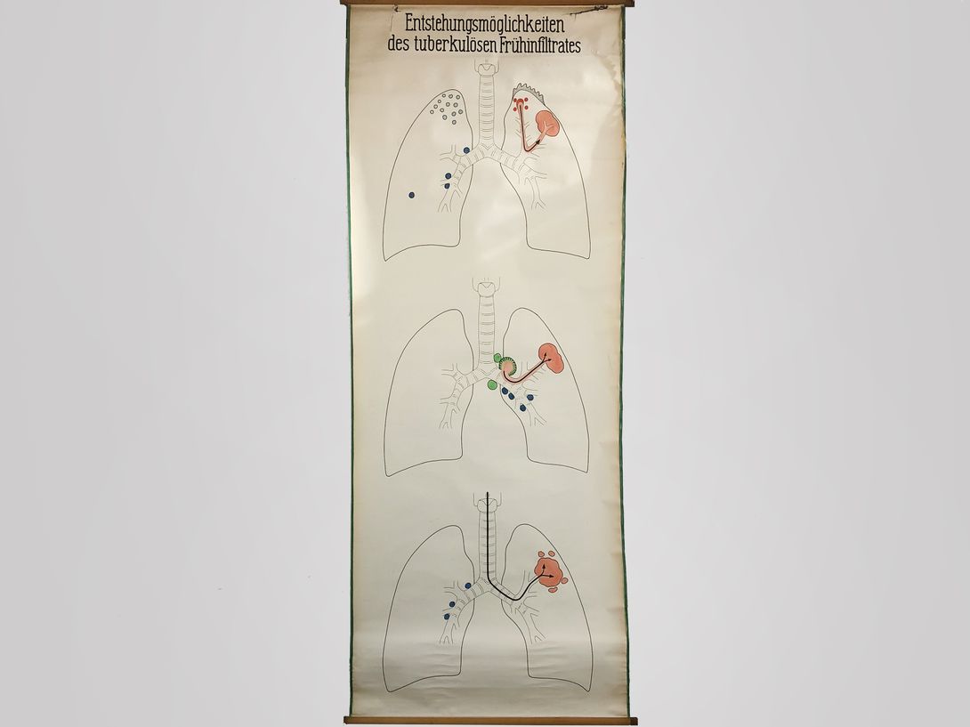Foto University Chart Tuberculosis h256x106
