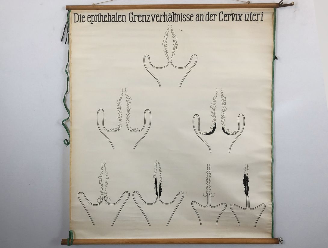 Foto University Chart Cervix Uteri h144x130