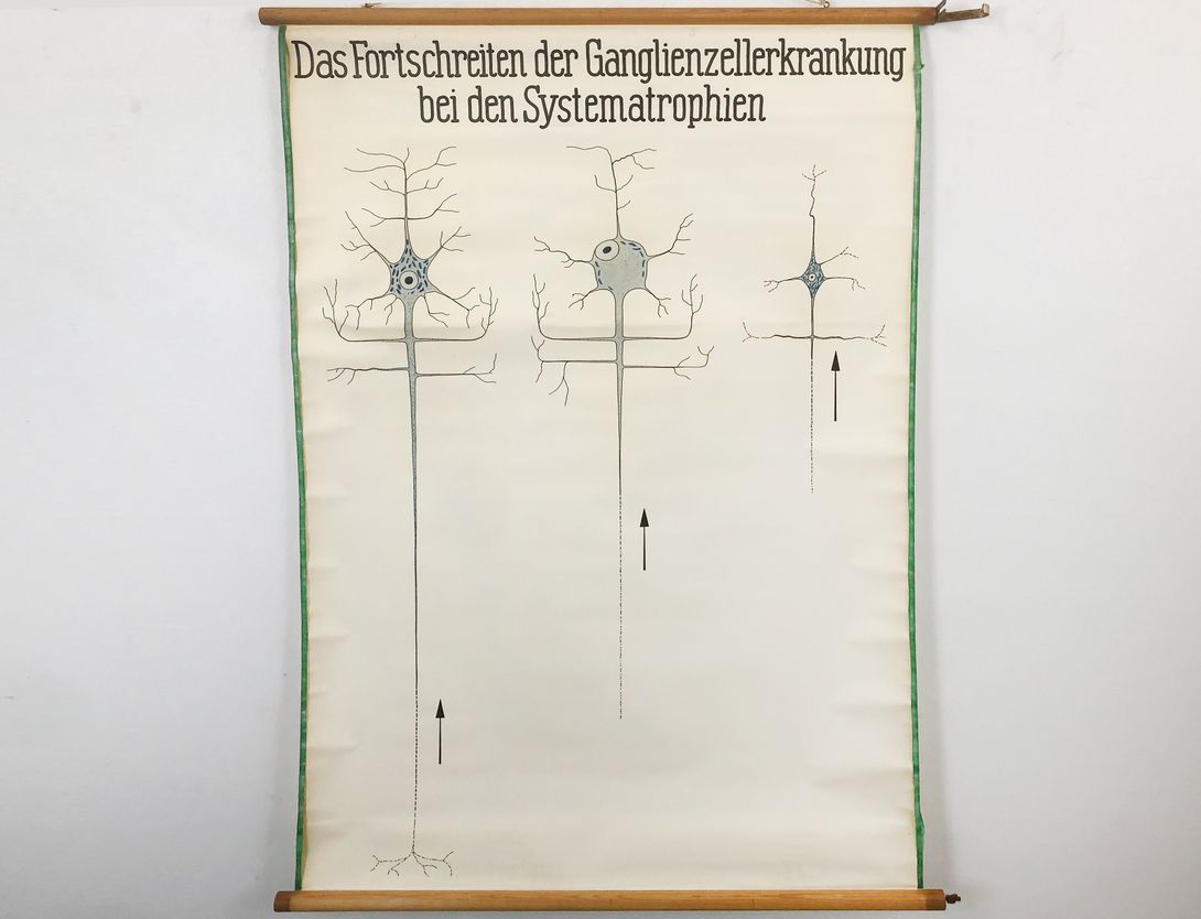 Foto Medical University Chart Ganglienzellerkrankung h149x113