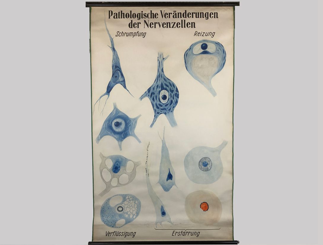Foto Medical University Chart Nervenzellen h243x150